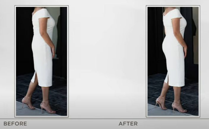 lady in white dress before and after wearing spanx